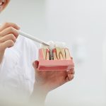 Bir Günde İmplant Diş Nasıl Yapılır?