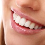 Gülüş Tasarımı Nedir? Nasıl Yapılır? Kalıcı mıdır?